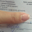 Мальчику, попавшему под фуру на трассе Симферополь-Керчь, срочно нужны доноры крови - 3652.Ru