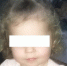 В Евпатории собака буквально оторвала лицо 4-летней девочке - Газета Крымская газета