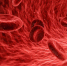Когда бить тревогу: врач назвала симптомы отрыва тромба - Crimea-news.com