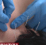 В симферопольском центре китайской традиционной медицины лечат детей с аутизмом и ДЦП - Crimea-news.com